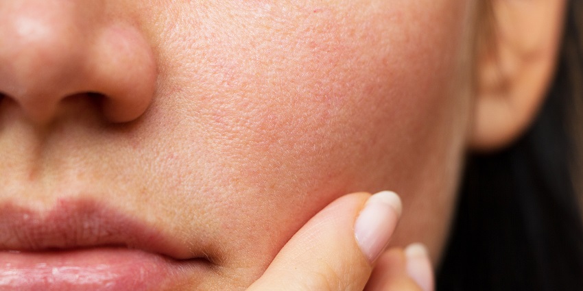 the cause of dry face skin
