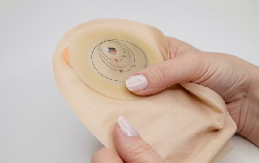 Clean a Colostomy Bag