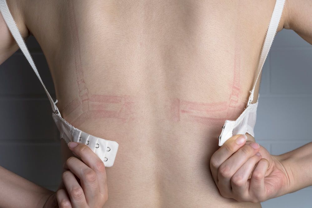 Can wearing the wrong bra cause boob pain?